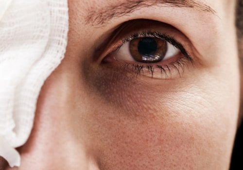 Can an Optometrist Treat Eye Injuries?